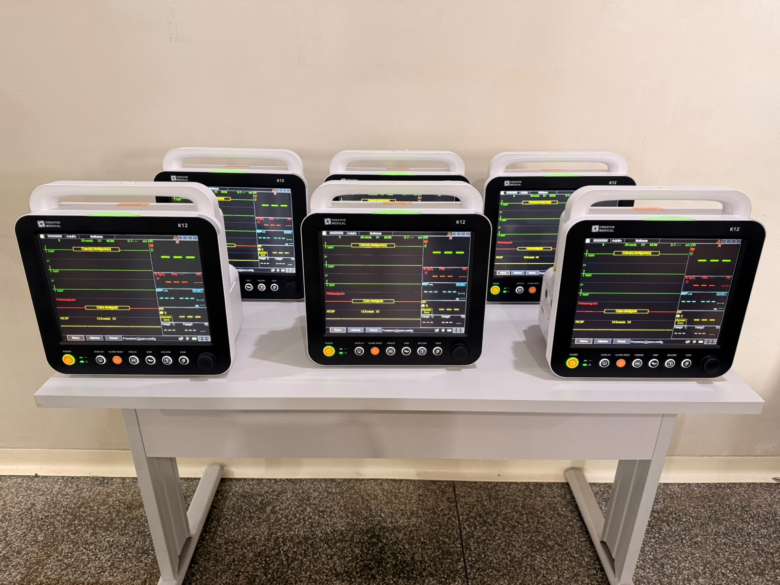 Missal adquire Monitores Cardíacos para equipar Unidades de Saúde
